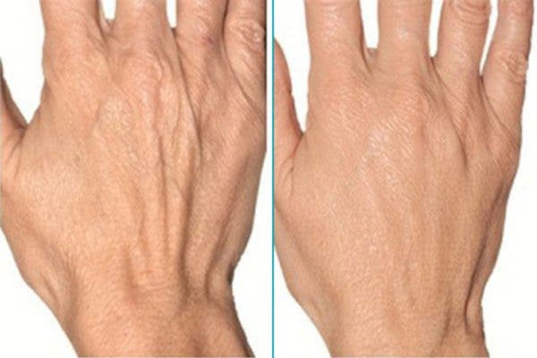 LasmaX-Skin® Skin Lightening Cream
